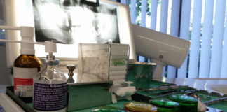 Rodzaje implantów zębowych: czym się kierować przy wyborze?