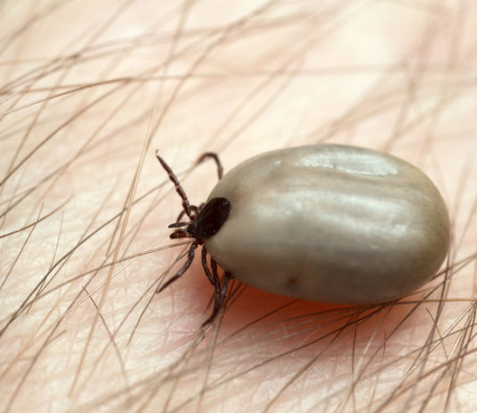 Badanie na boreliozę – wskazania i charakterystyka Badanie na boreliozę – wskazania i charakterystyka